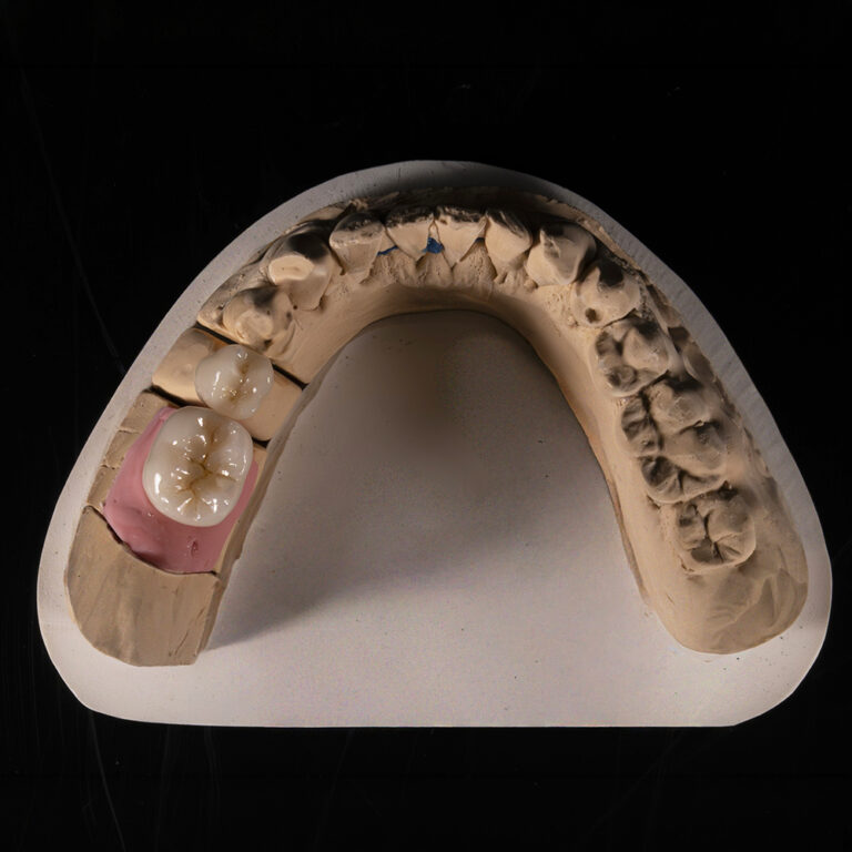 Implantattechnik_01