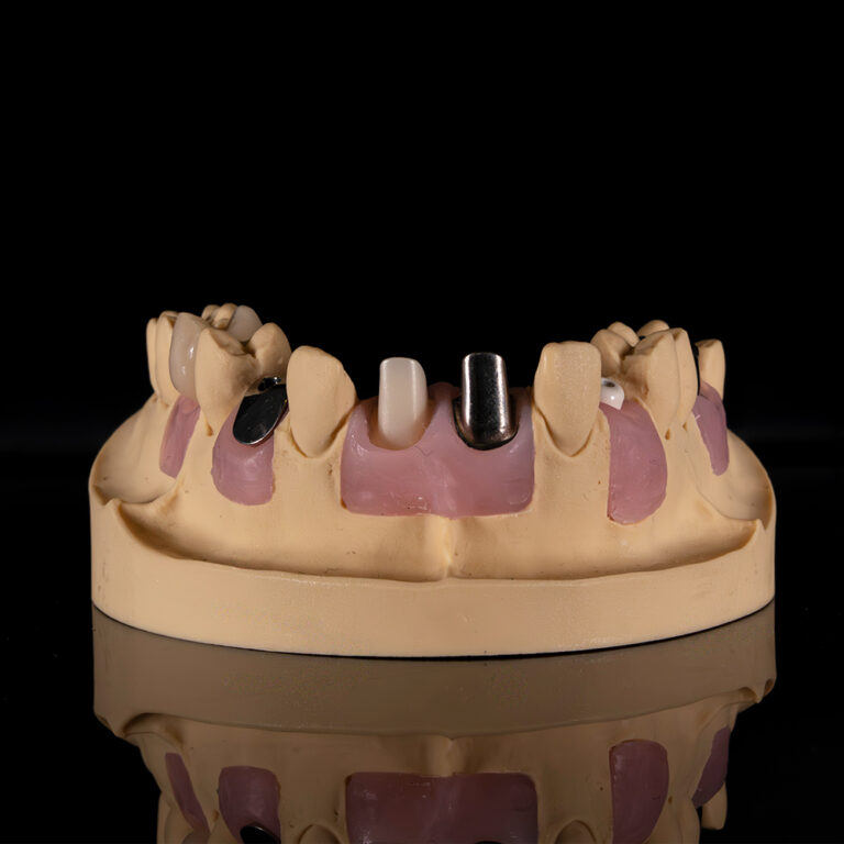 Implantattechnik_03