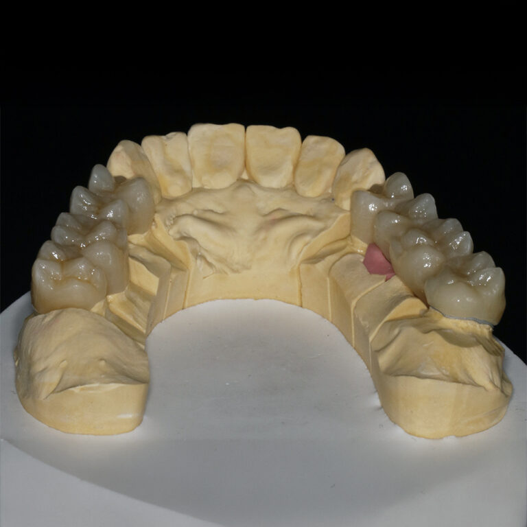 Implantattechnik_04
