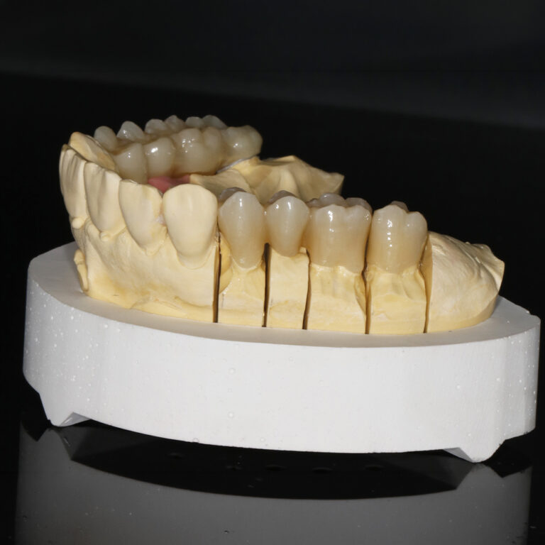 Implantattechnik_05